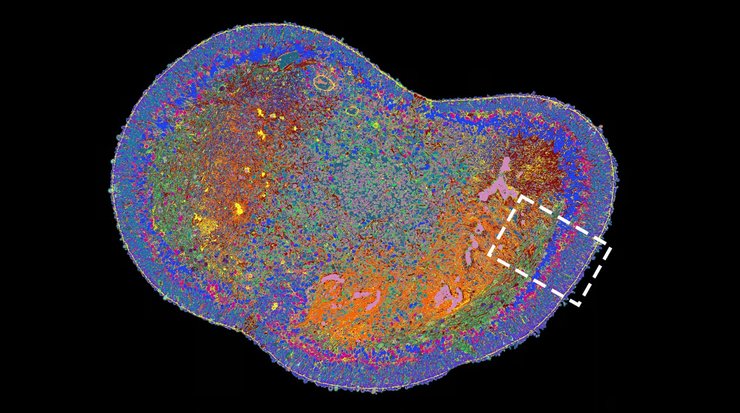 сетчатка фото белки