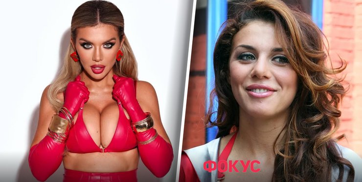 Анна Седокова пластика, трансформации Анны Седоковой, Дмитрий Слоссер об Анне Седоковой, пластические операции звезд, изменения во внешности Анны Седоковой, Янис Тимма смерть, Анна Седокова и Янис Тимма