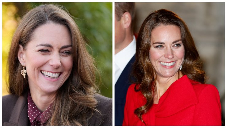 Кейт Миддлтон, пластический хирург о внешности Кейт Миддлтон, Кейт Миддлтон болезнь, Кейт Миддлтон внешность, операции Кейт Миддлтон