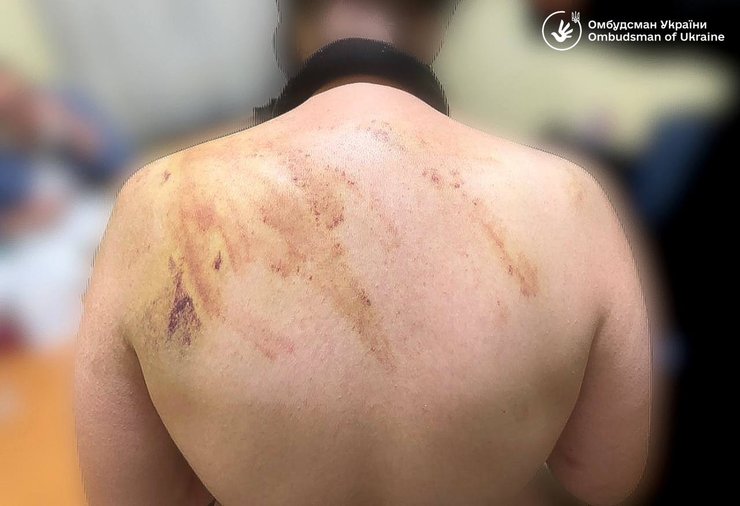 Подопечная интерната после избиения