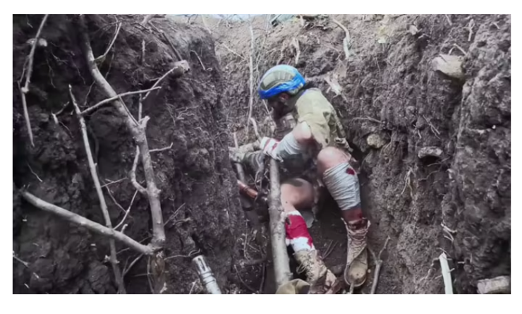 Сенцов показав Сенцов показав окопний бій в оточенні поблизу Авдіївки