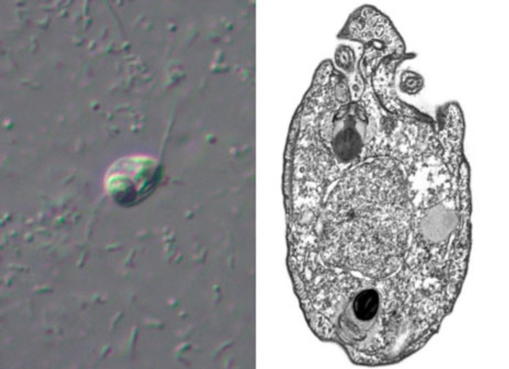 мікроорганізм, Ancoracysta twista, фото