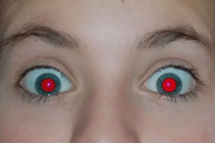 Красные глаза на фото, фото, вспышка, глаза, зрение, болезнь, редкая болезнь, сетчатка глаза, кровеносные сосуды, глаза человека