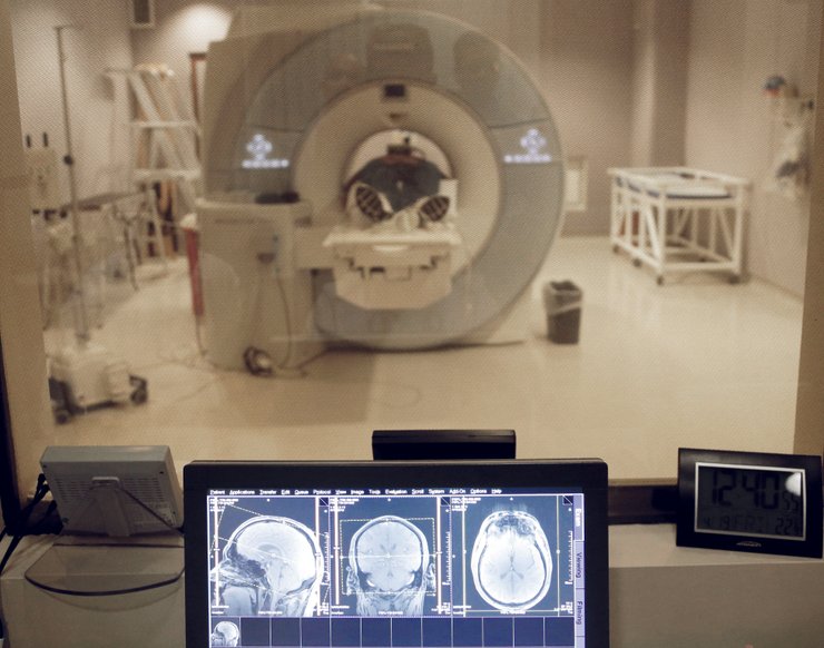 клетки мозга