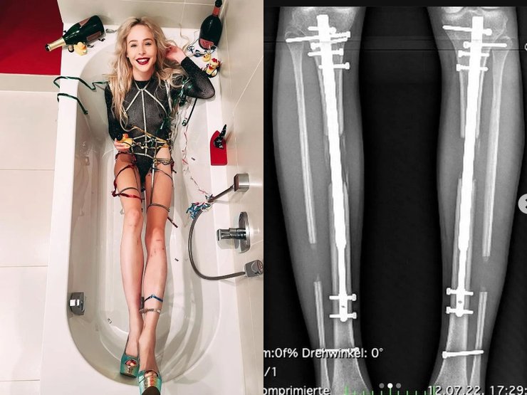 Модель, ноги, удлинение ног