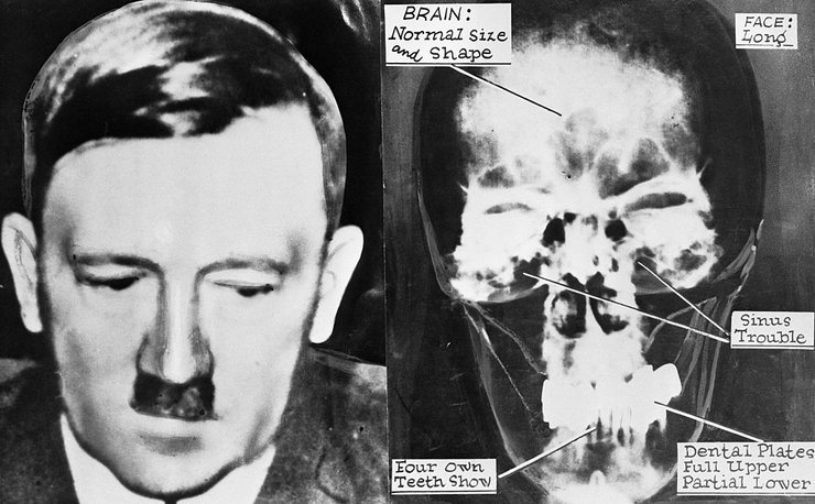 адольф гитлер, смерть гитлера, гитлер аргентина, гитлер бразилия, гитлер экспертиза, куда сбежал гитлер, где прятался гитлер, челюсть гитлера, череп гитлера