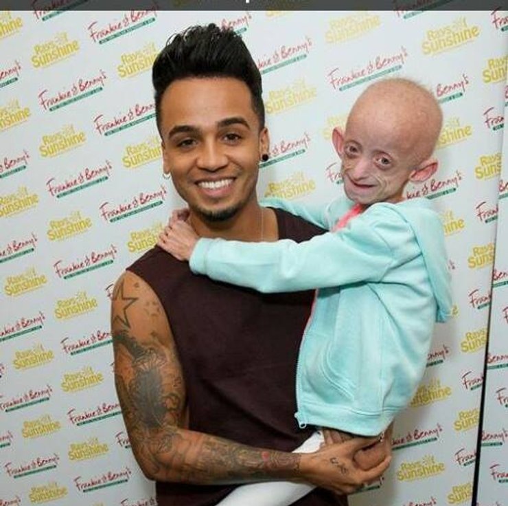 Ашанти Смит, прогерия