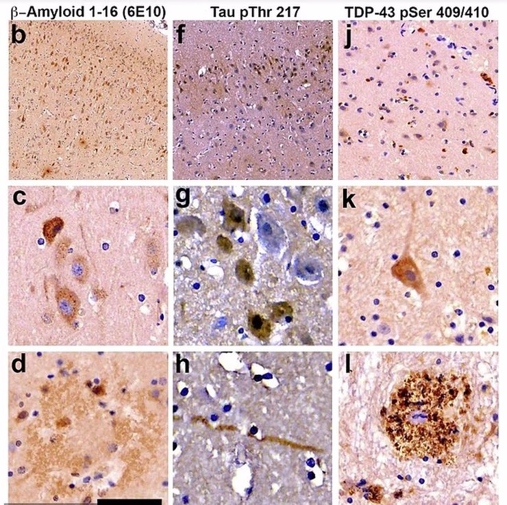 Дельфіни викидаються на берег із мутованим мозком: це загрожує мільйонам людей1