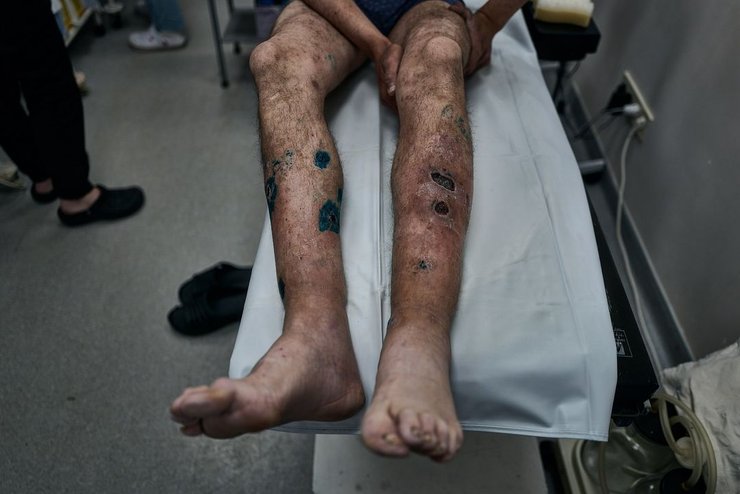 Обмен пленными, пленные 25 июня, пленные ВСУ, пленные здоровье, пленные здоровье