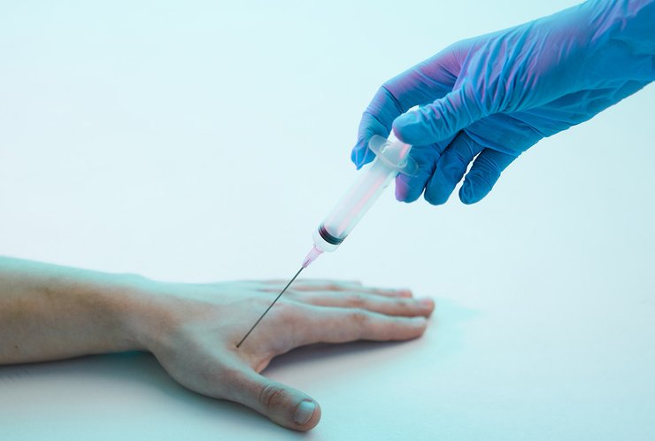 чипирование, подкожная инъекция