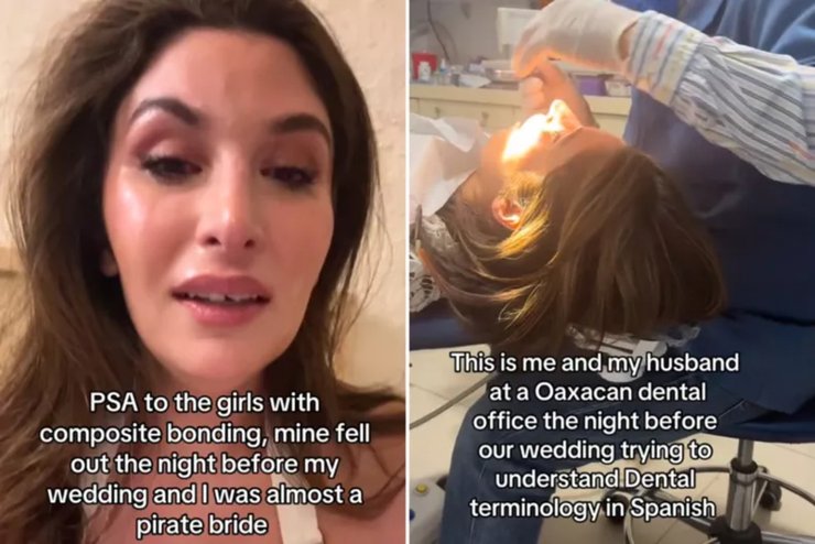 Невеста, свадьба, свадебное платье, невеста с букетом, невеста потеряла зуб, передний зуб, выпала пломба, потеряла зуб перед свадьбой