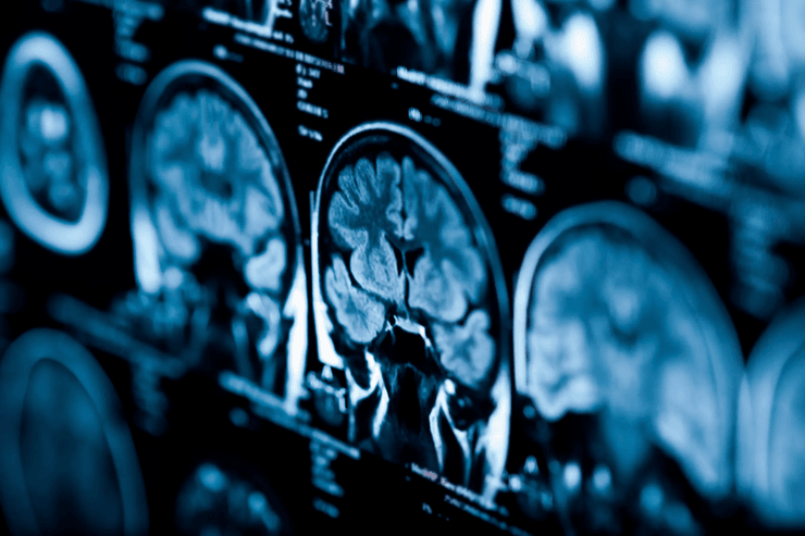 мозг, сканирование, снимок, фото