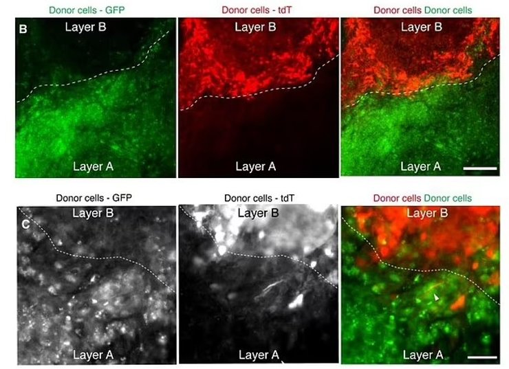 клетки мозга