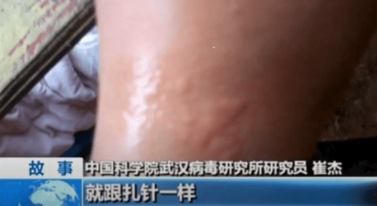 Припухлость от укуса, Китайские ученые