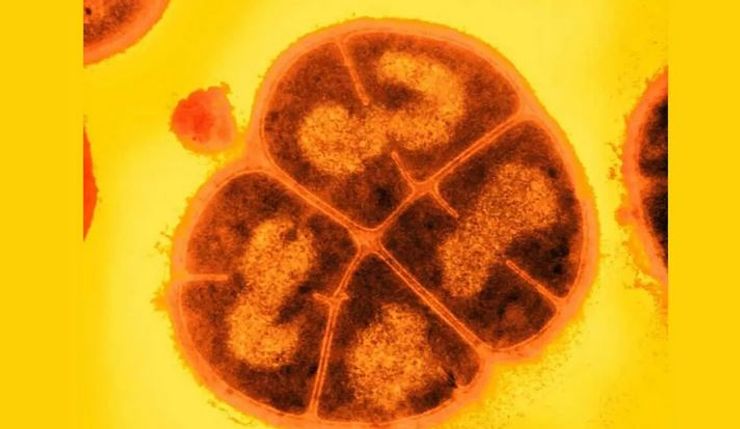 бактерія Deinococcus radiodurans