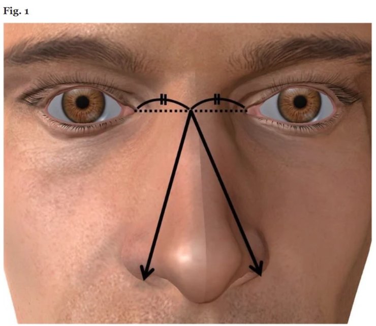 ннос, чоловічу гідність