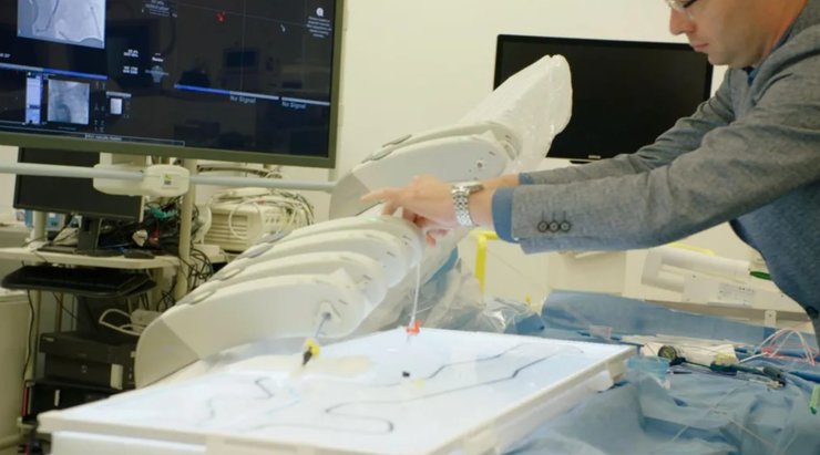 робот операция операция, робот, тромбэктомия, инсульт