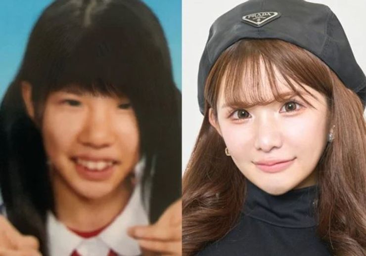 Хирасе Аири, Япония, пластические операции, хирургическое вмешательство, фото, внешность, красота, идеалы красоты, курьезы