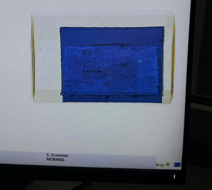 кадр с рентген-устройства