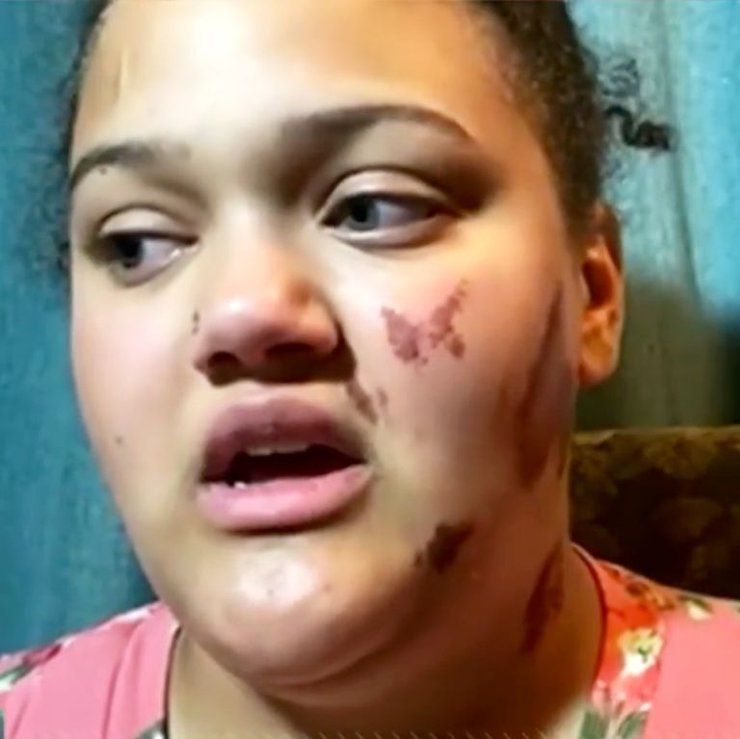 алтея бернштейн