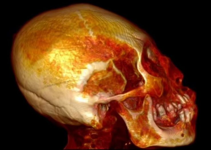 мумія інопланетянин Перу