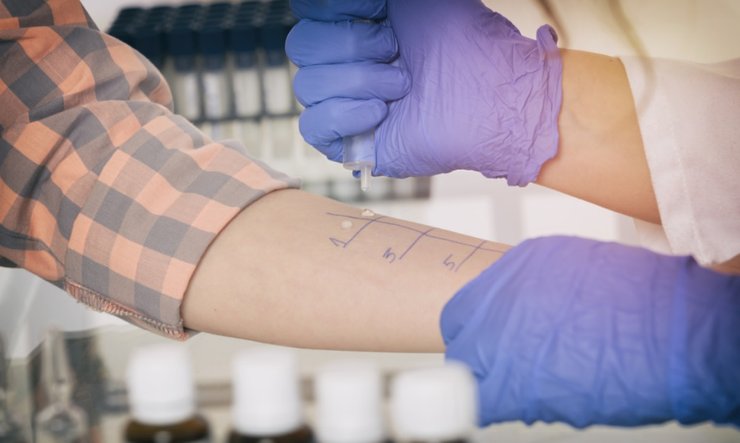 тест, аллергия, сезонная аллергия