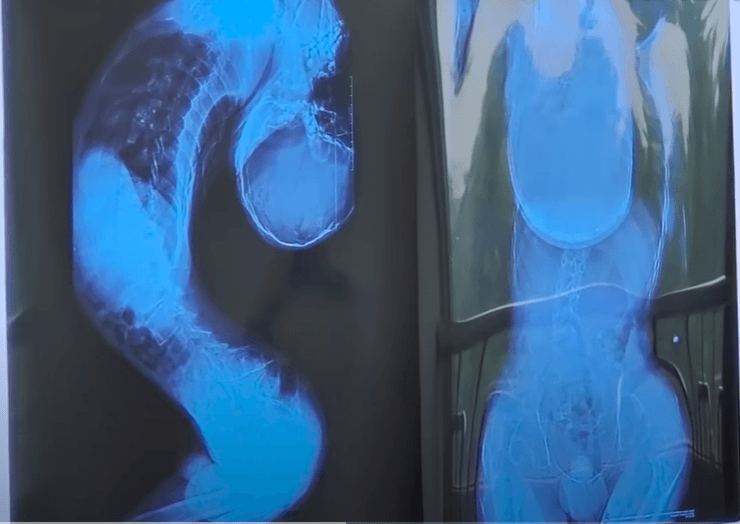 зламаний хлопчик