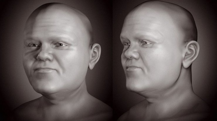 Средневековье, карлик, реконструкция лица, череп, палеореконструкция, 3D-моделирование, реконструкция лица по черепу, скелетная дисплазия