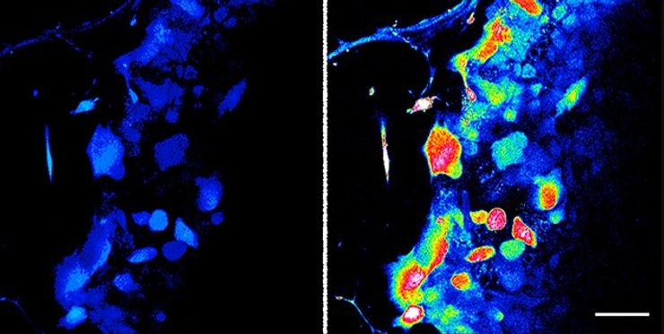 волосы осязание нервы