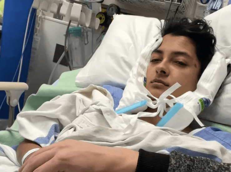 Джаверия после операции