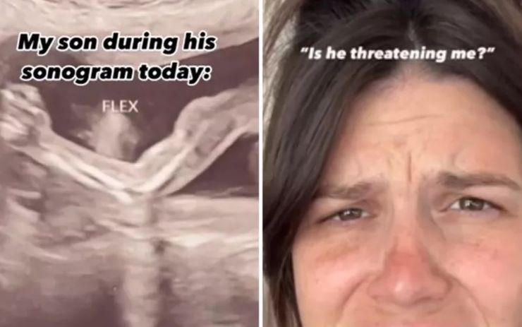 УЗИ, исследования, ребенок в утробе матери, интересные истории, невероятные случаи из жизни