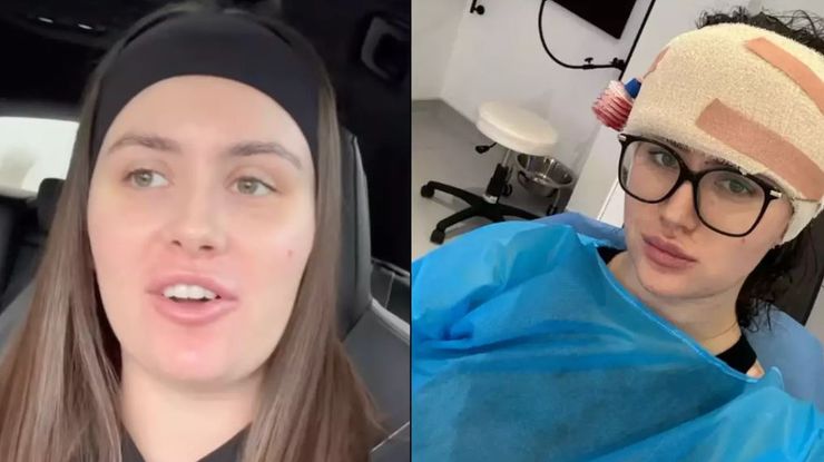 Пластична операція на обличчі, фото до та після процедури, хірургічне втручання, як зменшити чоло