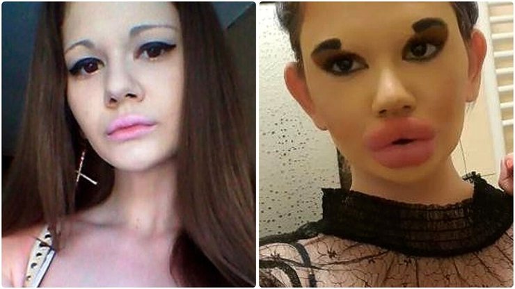 Андреа Иванова из Болгарии, самые большие в мире губы. красота, внешность, косметические процедуры, трансформация, фото, курьезы