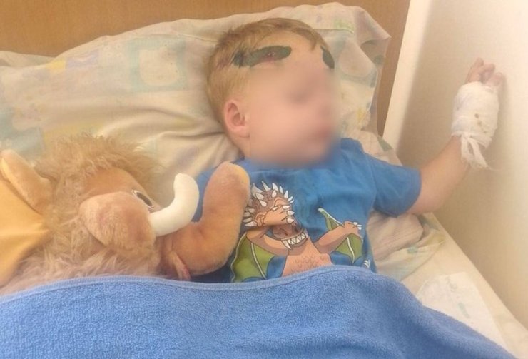 фото постражлого внаслідок ДТП під Одесою 3 вересня