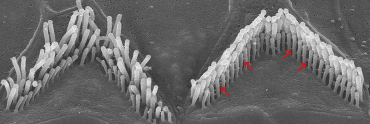 генна терапія, внутрішнє вухо, глухота, лікування