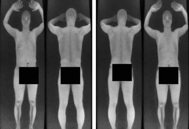 Примеры изображений тела, получаемых старыми рентгеновскими сканерами безопасности в аэропортах