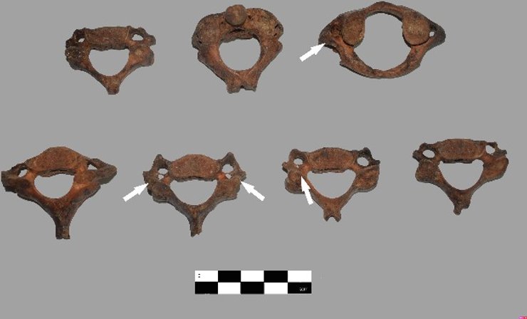 шийні хребці, стрілочки, фото