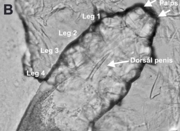 Demodex folliculorum