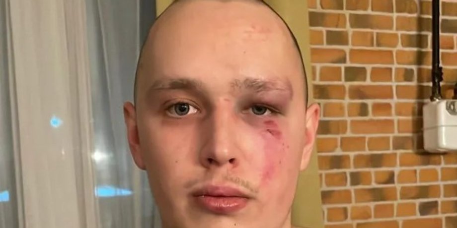 Ветеран ЗСУ Олексій Іванін, побиття військового, ветеран лікарня, скандал у лікарні, лікарня побиття людини