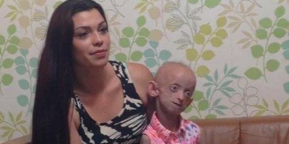 Ашанти Смит, прогерия