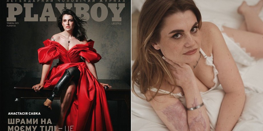 Українки зі шрамами війни у Playboy
