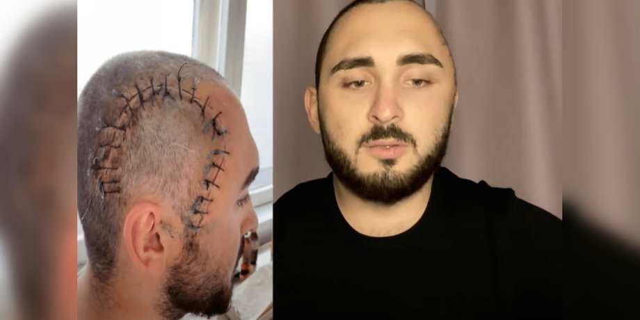 избиение, Киев, блогер