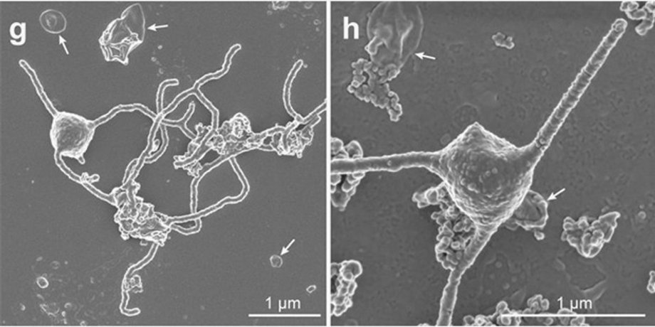 Фото: Prometheoarchaeum syntrophicum. Фото: Imachi et al., bioRxiv