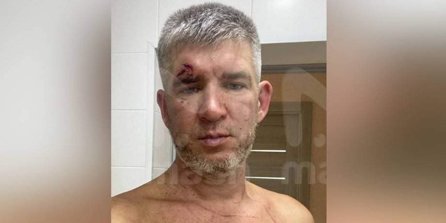побитий чоловік, оліг із севастополя, дружина побила чоловіка