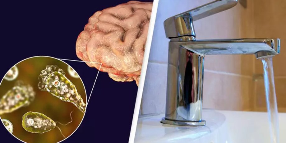 Кран, вода, бактерія, мозок, захворювання, інфекція, зараження, Naegleria fowleri