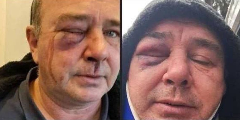 побили чоловіка