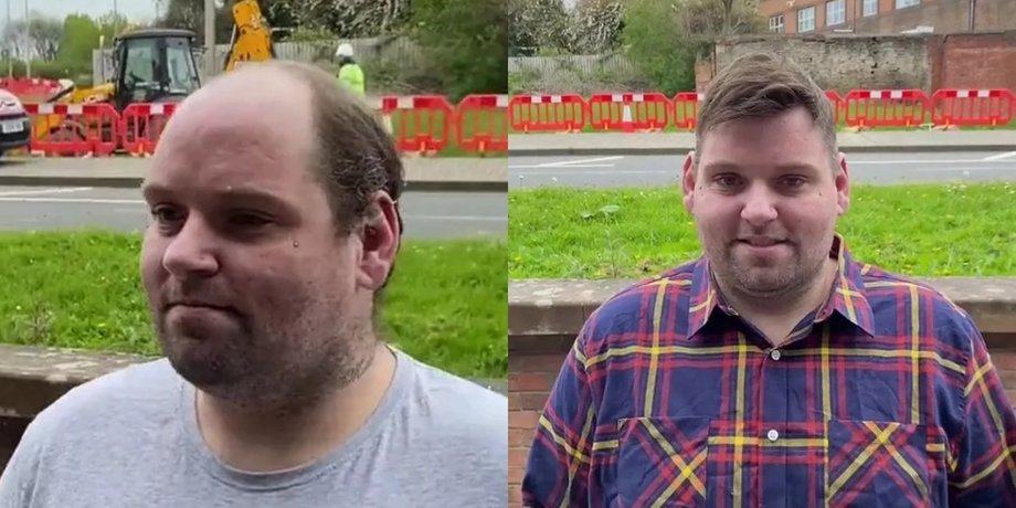 Мужчина разрыдался из-за прически, лысеющий мужчина, лысина, облысел на макушке, потерял волосы, вернули волосы, прическа