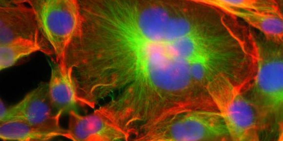 Гигантские раковые клетки, выделенные синим цветом. Фото: Michelle Dawson / Brown University