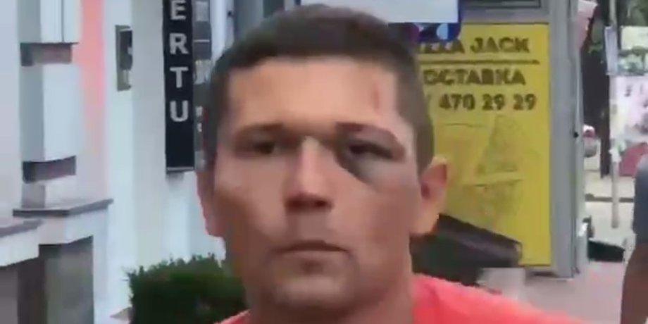 УДО, співробітник, Дорофєєва, танцюрист, побиття,