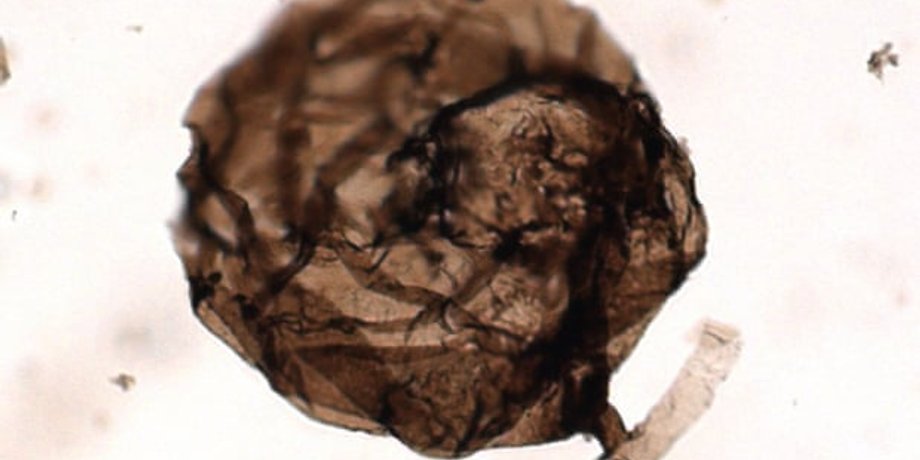 Грибы Ourasphaira giraldae под микроскопом. C.C Loron, University of Liège